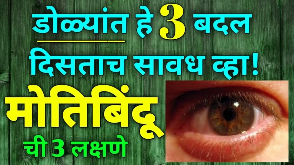 डोळ्यांत हे 3 बदल दिसताच सावध व्हा!!मोतिबिंदूची 3 लक्षणे…