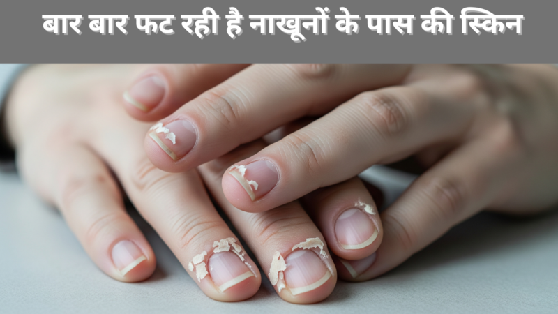 बार बार फट रही है नाखूनों के पास की स्किन? जानें क्या कहती है आपकी सेहत और किस्मत